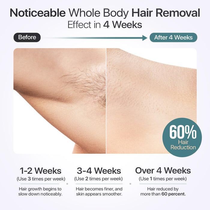 IPL Laser Hair Removal for Women & Men with Cooling Technology | 5 Modes LCD Screen for Painless Face & Body Treatments